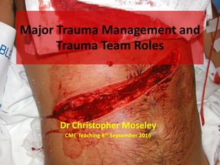 Major Trauma Management and
Trauma Team Roles
Dr Christopher Moseley
CME Teaching 8th September 2016
 