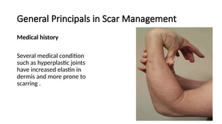 Scar Management Program managment of scar in facial area.pptxsss | PPTX