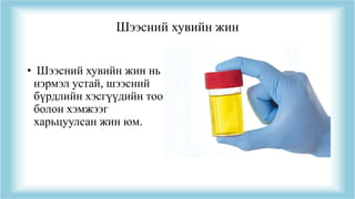 Шээсний хувийн жин
• Шээсний хувийн жин нь
нэрмэл устай, шээсний
бүрдлийн хэсгүүдийн тоо
болон хэмжээг
харьцуулсан жин юм.
 