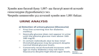 Хувийн жин багатай буюу 1,007- аас багагүй жинтэй шээсийг
гипостенурик (hyposthenuric) гэнэ.
Чихрийн шижингийн үед шээсний хувийн жин 1,001 байдаг.
 