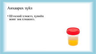 Анхаарах зүйл
• Шээсний хэмжээ, хувийн
жинг зөв хэмжинэ.
 