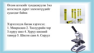Өгсөн шээсийг тундасжуулж 1мл
шээсэндэх дүрст элемэнтүүдийг
судалдаг байна
Хэрэглэгдэх багаж хэрэгсэл:
1. Микроскоп 2. Тоолуурийн тор
3.хуруу шил 4. Хуруу шилний
тавиур 5. Шилэн савх 6. Соруул
 