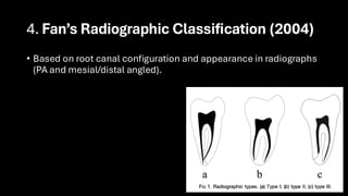 C shape classification and cases presentation | PDF