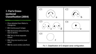 C shape classification and cases presentation | PDF