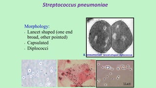 Streptococcus pneumoniae
Morphology:
• Lancet shaped (one end
broad, other pointed)
• Capsulated
• Diplococci
S. pneumoniae: lancet-shaped diplococcus
 