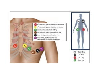 Simple Approach Ecg ECG how to read. Easy ECG. Simplified ECG.pptx