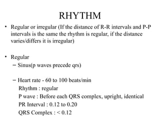 ECG how to read. Easy ECG. Simplified ECG.pptx
