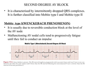 ECG how to read. Easy ECG. Simplified ECG.pptx