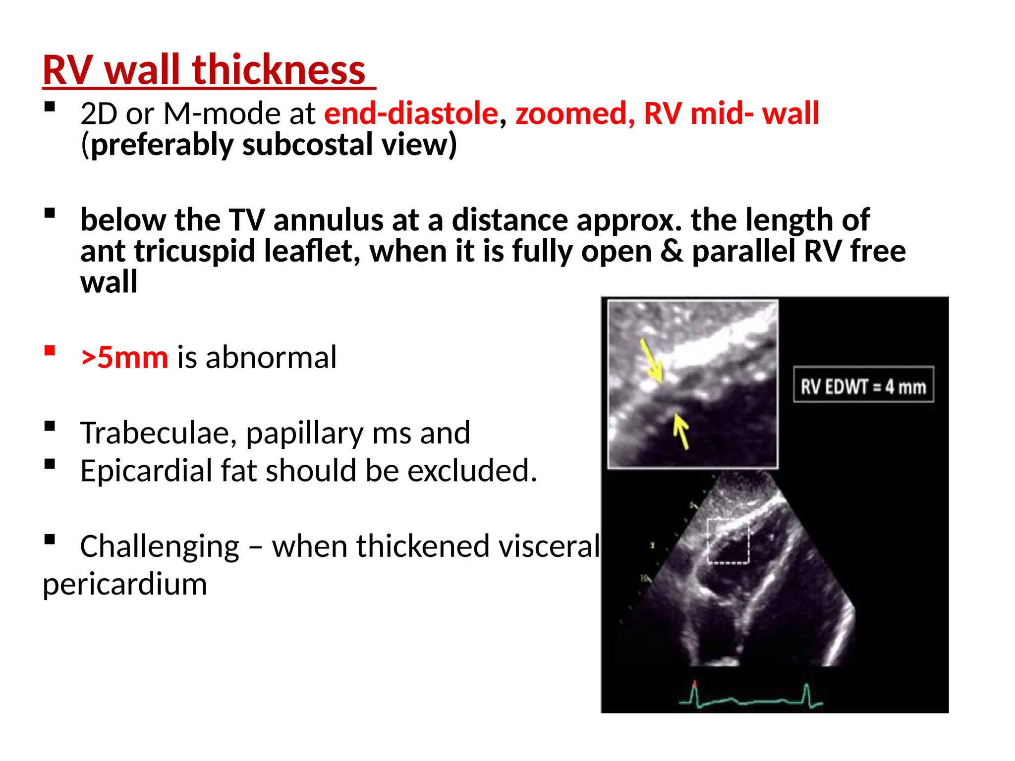 RV wall thickness
 2D or M-mode at end-diastole, zoomed, RV mid- wall
(preferably subcostal view)
 below the TV annulus at a distance approx. the length of
ant tricuspid leaflet, when it is fully open & parallel RV free
wall
 >5mm is abnormal
 Trabeculae, papillary ms and
 Epicardial fat should be excluded.
 Challenging – when thickened visceral
pericardium
 