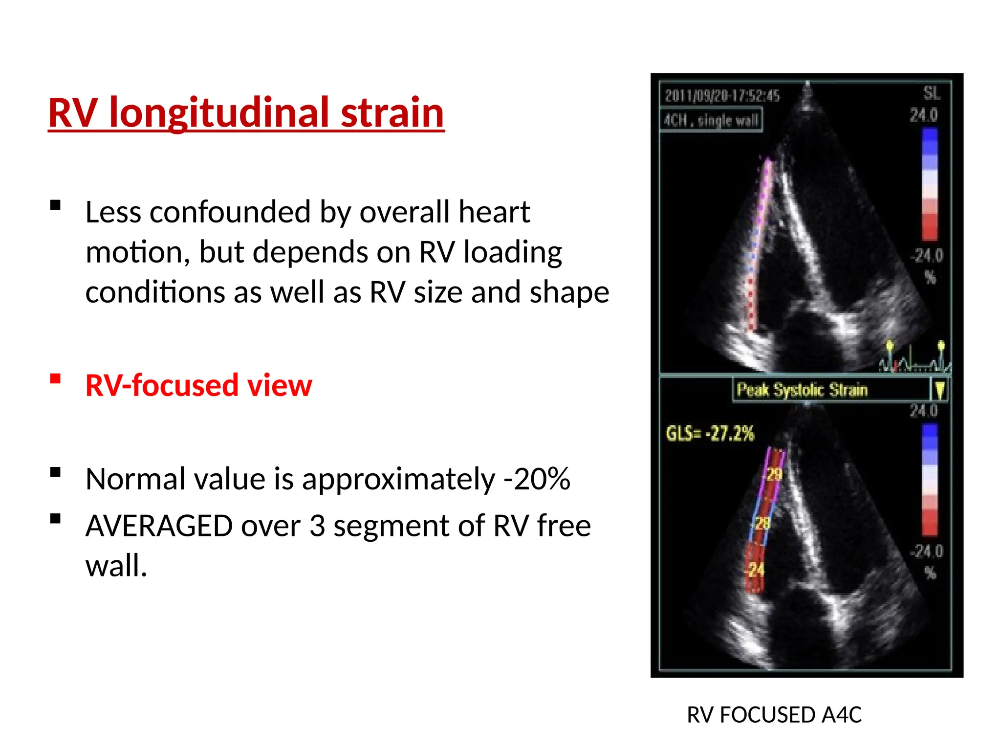 RV longitudinal strain
 Less confounded by overall heart
motion, but depends on RV loading
conditions as well as RV size and shape
 RV-focused view
 Normal value is approximately -20%
 AVERAGED over 3 segment of RV free
wall.
RV FOCUSED A4C
 