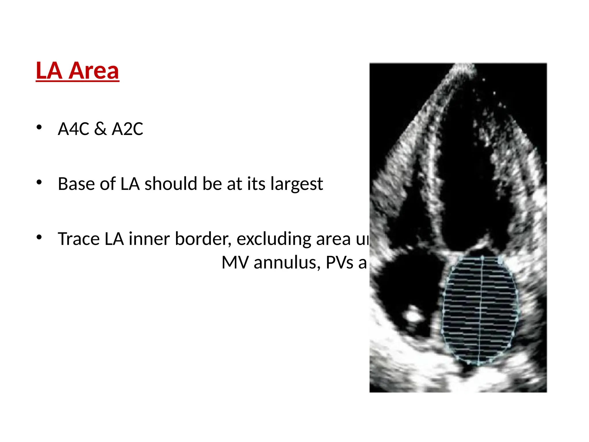 LA Area
• A4C & A2C
• Base of LA should be at its largest
• Trace LA inner border, excluding area under
MV annulus, PVs and LA appendage
 