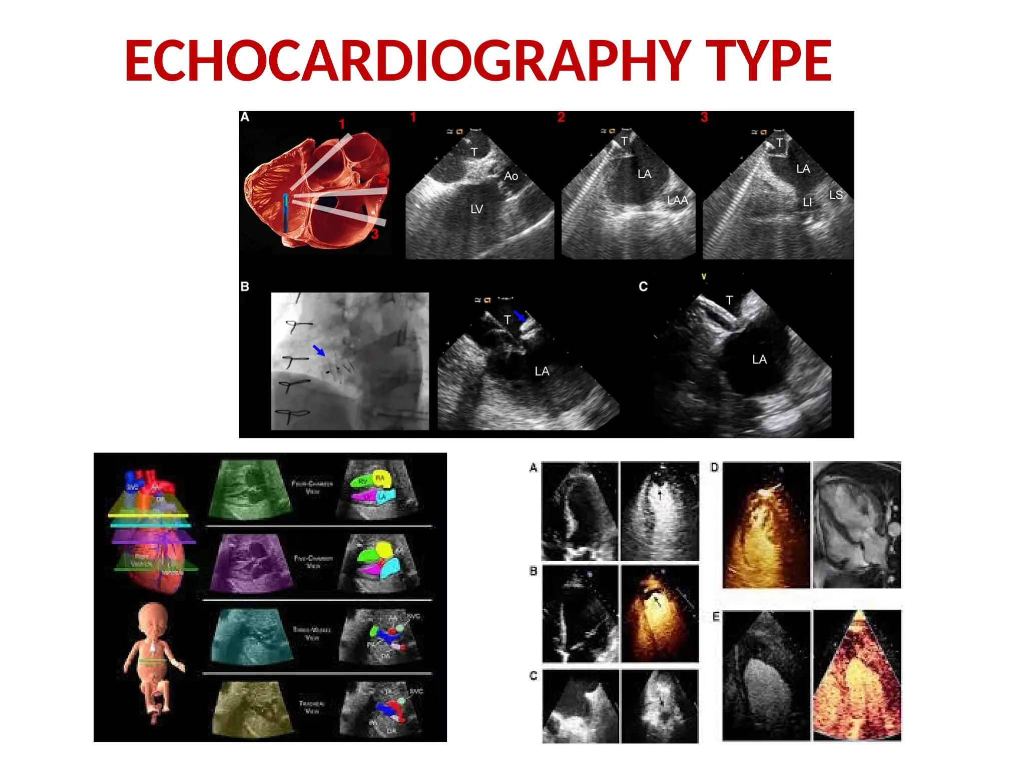 ECHOCARDIOGRAPHY TYPE
 