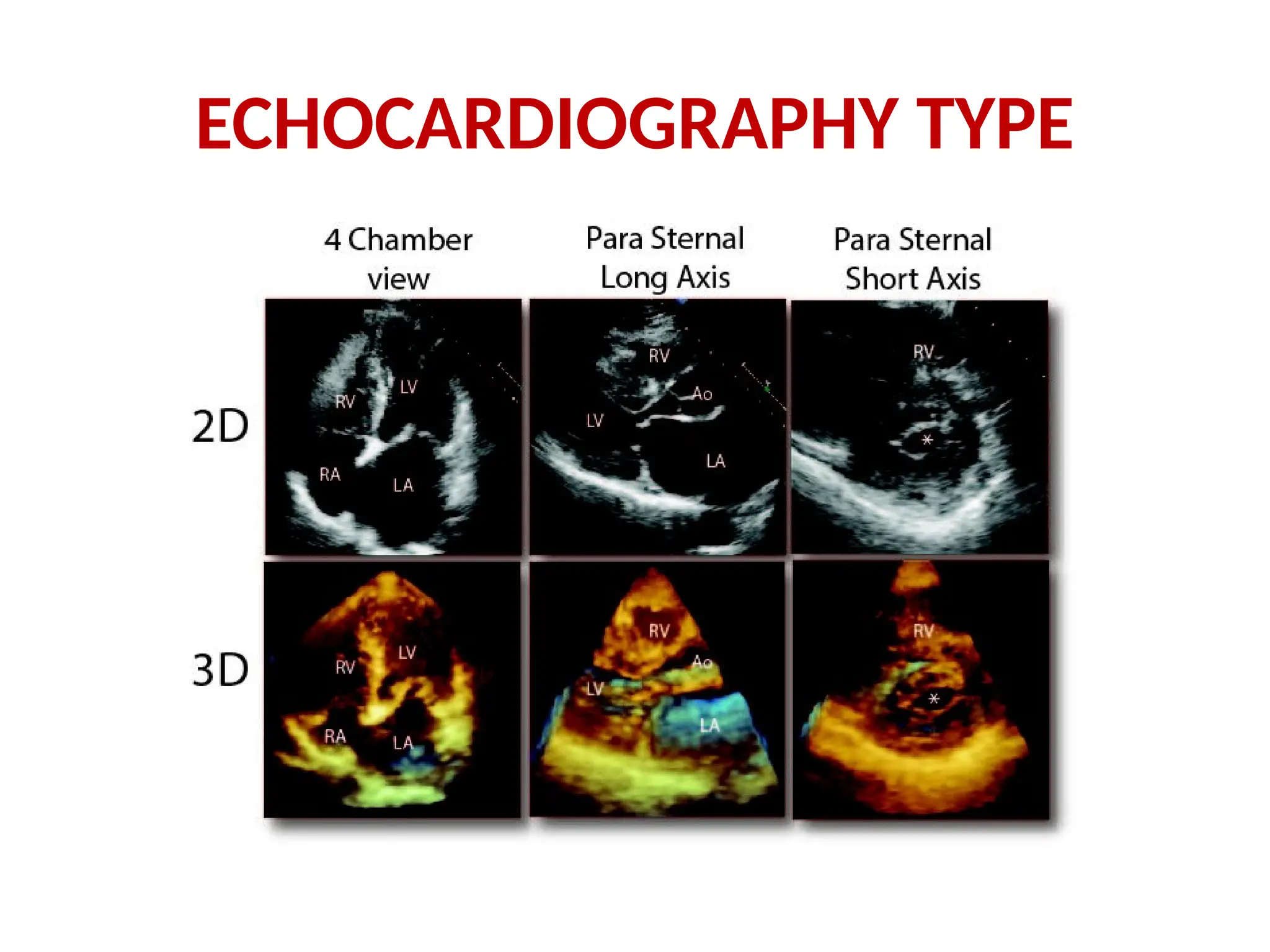 ECHOCARDIOGRAPHY TYPE
 