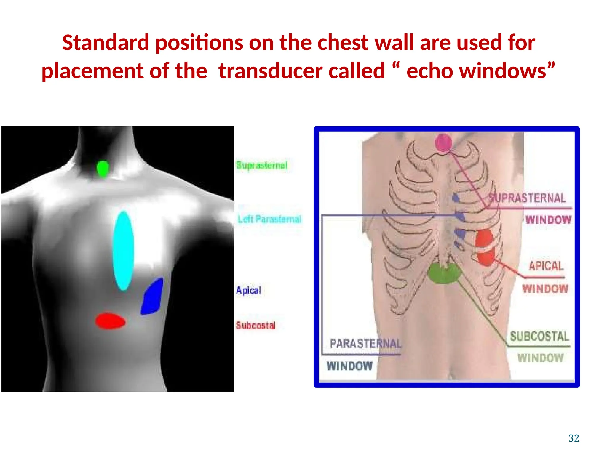 Standard positions on the chest wall are used for
placement of the transducer called “ echo windows”
32
 