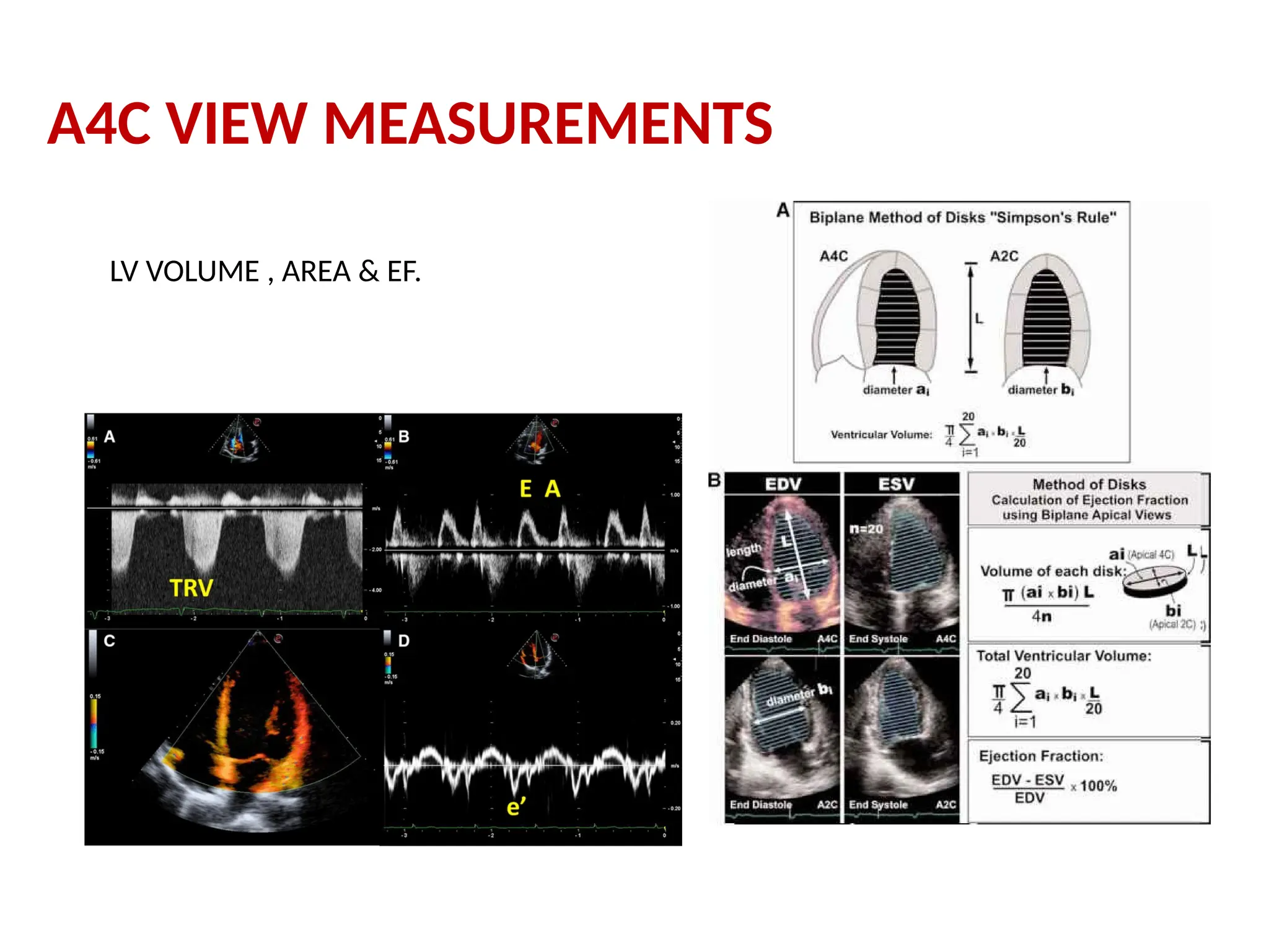 A4C VIEW MEASUREMENTS
LV VOLUME , AREA & EF.
 