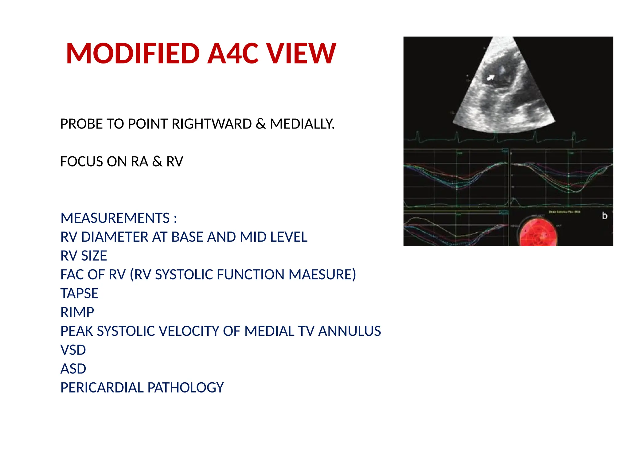 MODIFIED A4C VIEW
PROBE TO POINT RIGHTWARD & MEDIALLY.
FOCUS ON RA & RV
MEASUREMENTS :
RV DIAMETER AT BASE AND MID LEVEL
RV SIZE
FAC OF RV (RV SYSTOLIC FUNCTION MAESURE)
TAPSE
RIMP
PEAK SYSTOLIC VELOCITY OF MEDIAL TV ANNULUS
VSD
ASD
PERICARDIAL PATHOLOGY
 