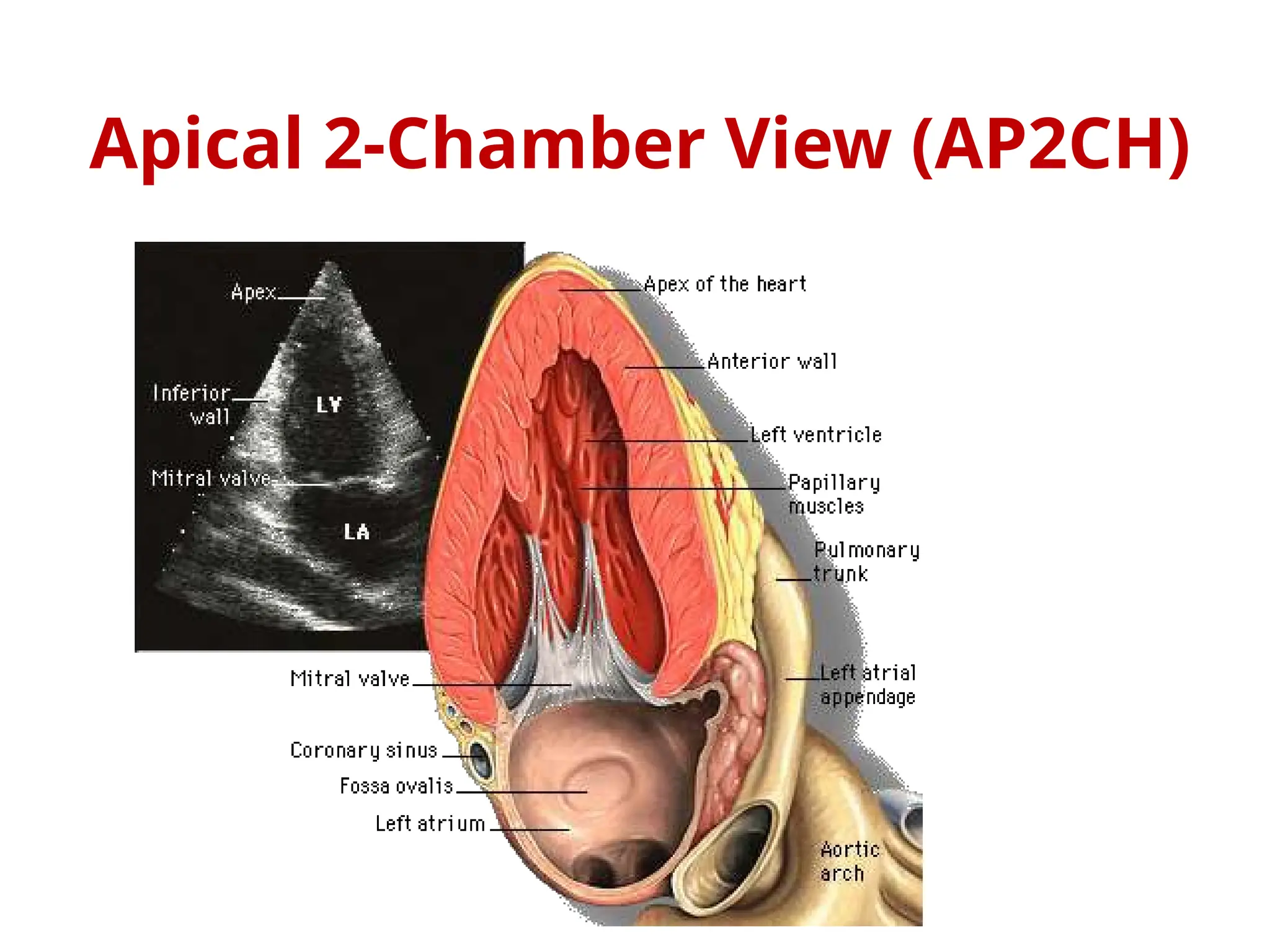 Apical 2-Chamber View (AP2CH)
 