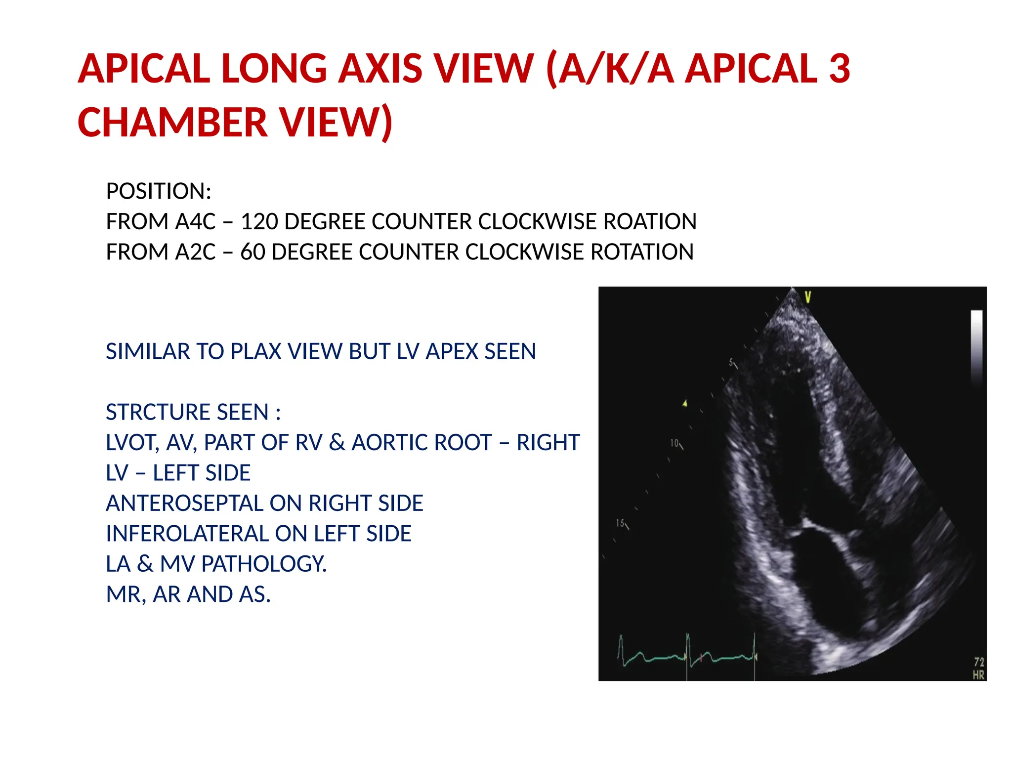 APICAL LONG AXIS VIEW (A/K/A APICAL 3
CHAMBER VIEW)
POSITION:
FROM A4C – 120 DEGREE COUNTER CLOCKWISE ROATION
FROM A2C – 60 DEGREE COUNTER CLOCKWISE ROTATION
SIMILAR TO PLAX VIEW BUT LV APEX SEEN
STRCTURE SEEN :
LVOT, AV, PART OF RV & AORTIC ROOT – RIGHT
LV – LEFT SIDE
ANTEROSEPTAL ON RIGHT SIDE
INFEROLATERAL ON LEFT SIDE
LA & MV PATHOLOGY.
MR, AR AND AS.
 