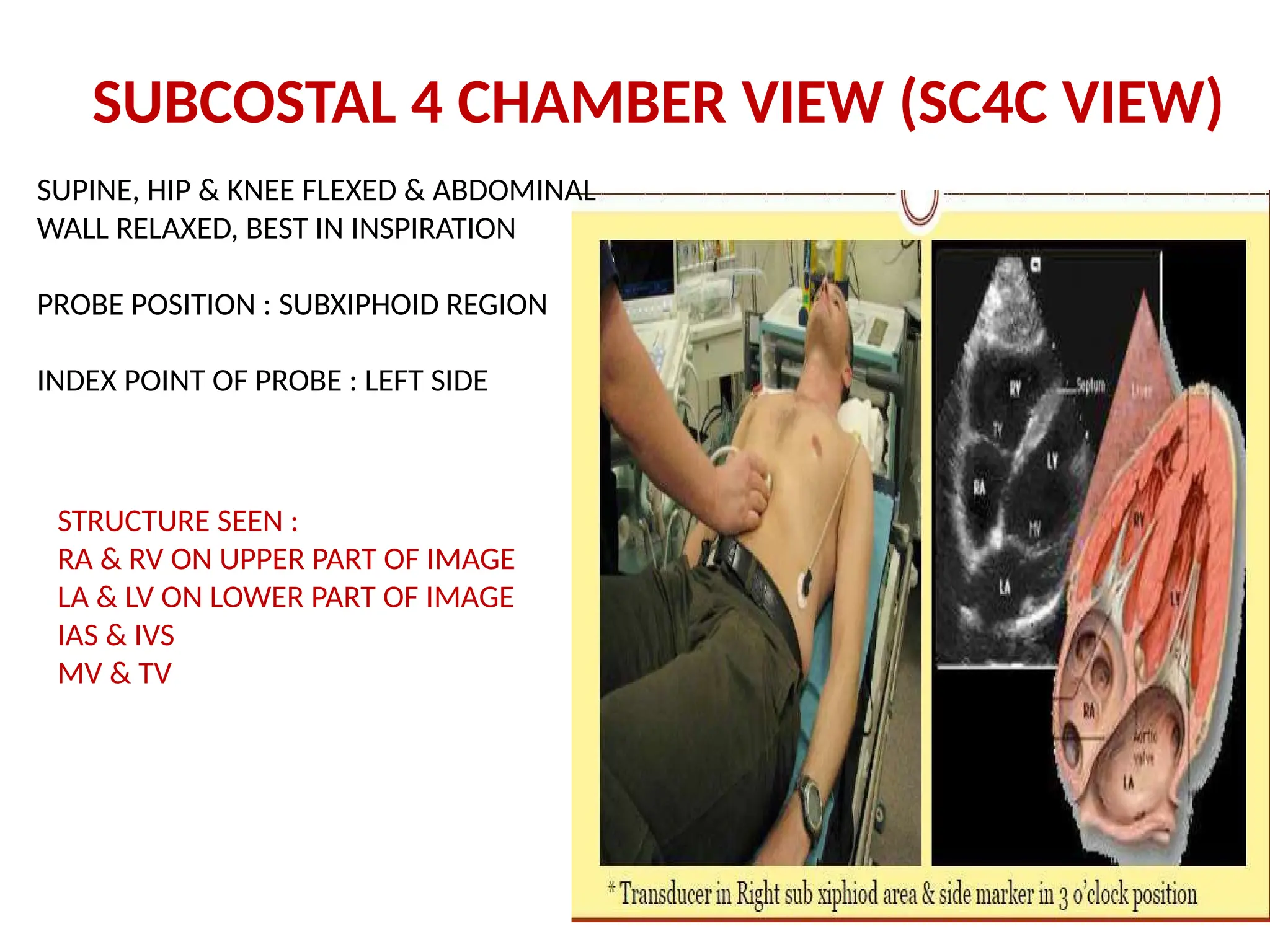 SUPINE, HIP & KNEE FLEXED & ABDOMINAL
WALL RELAXED, BEST IN INSPIRATION
PROBE POSITION : SUBXIPHOID REGION
INDEX POINT OF PROBE : LEFT SIDE
STRUCTURE SEEN :
RA & RV ON UPPER PART OF IMAGE
LA & LV ON LOWER PART OF IMAGE
IAS & IVS
MV & TV
SUBCOSTAL 4 CHAMBER VIEW (SC4C VIEW)
 