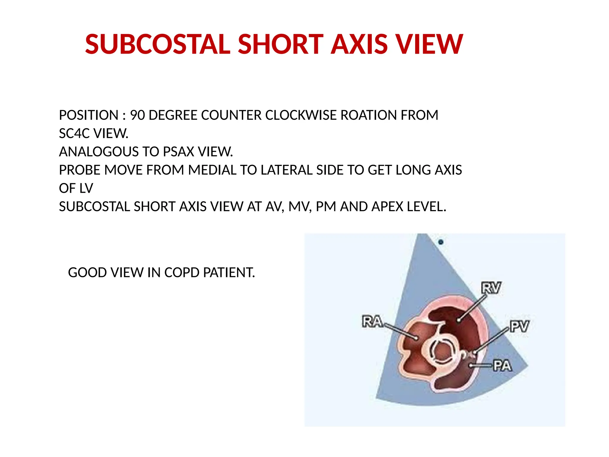 SUBCOSTAL SHORT AXIS VIEW
POSITION : 90 DEGREE COUNTER CLOCKWISE ROATION FROM
SC4C VIEW.
ANALOGOUS TO PSAX VIEW.
PROBE MOVE FROM MEDIAL TO LATERAL SIDE TO GET LONG AXIS
OF LV
SUBCOSTAL SHORT AXIS VIEW AT AV, MV, PM AND APEX LEVEL.
GOOD VIEW IN COPD PATIENT.
 