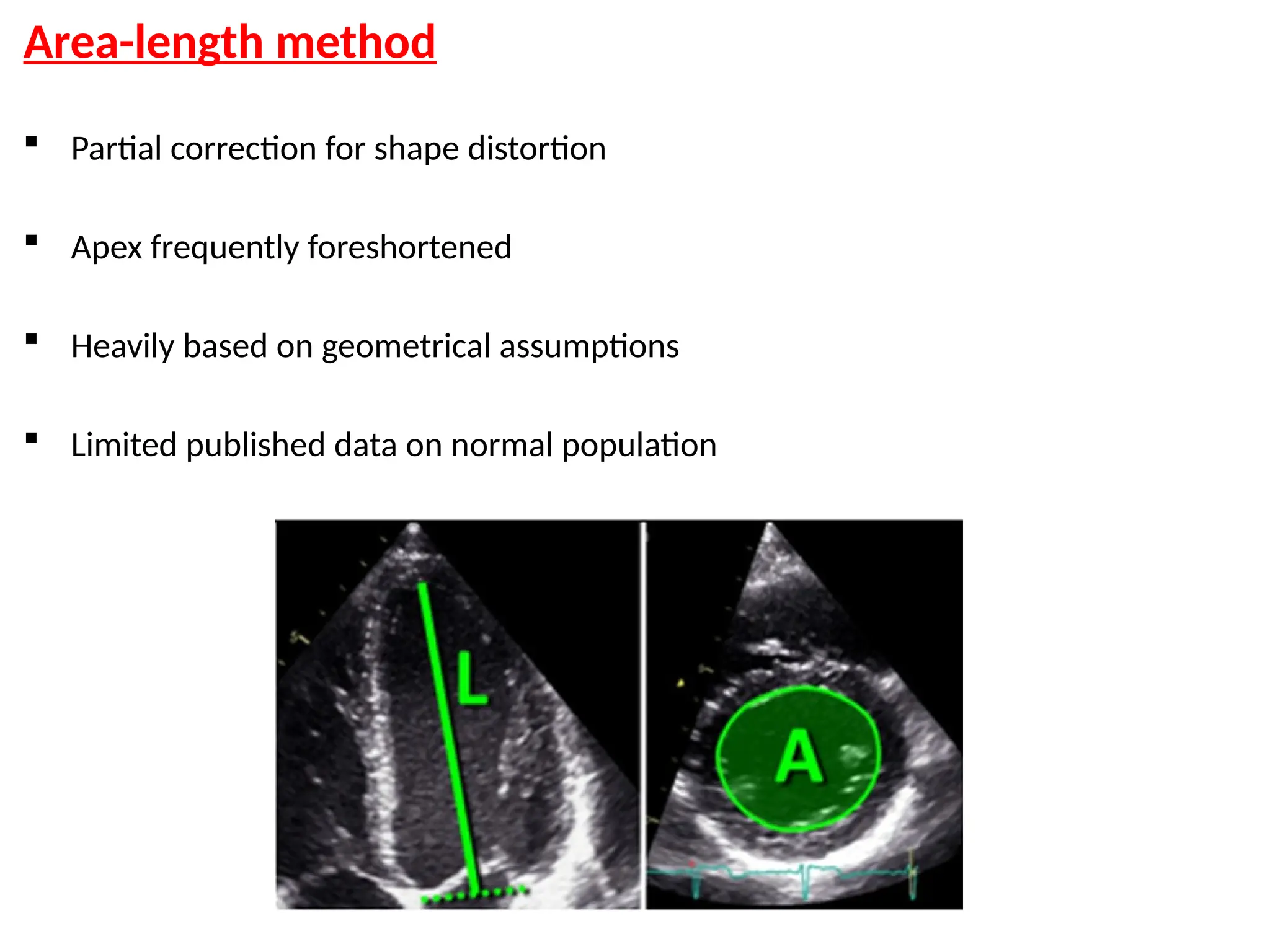 Area-length method
 Partial correction for shape distortion
 Apex frequently foreshortened
 Heavily based on geometrical assumptions
 Limited published data on normal population
 
