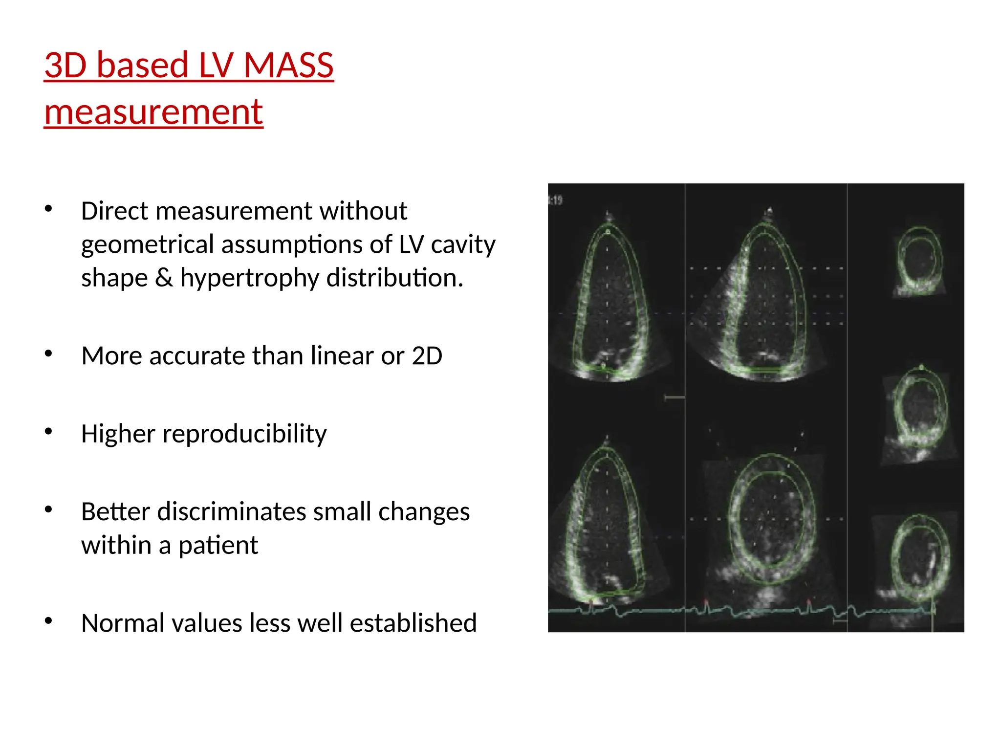 3D based LV MASS
measurement
• Direct measurement without
geometrical assumptions of LV cavity
shape & hypertrophy distribution.
• More accurate than linear or 2D
• Higher reproducibility
• Better discriminates small changes
within a patient
• Normal values less well established
 