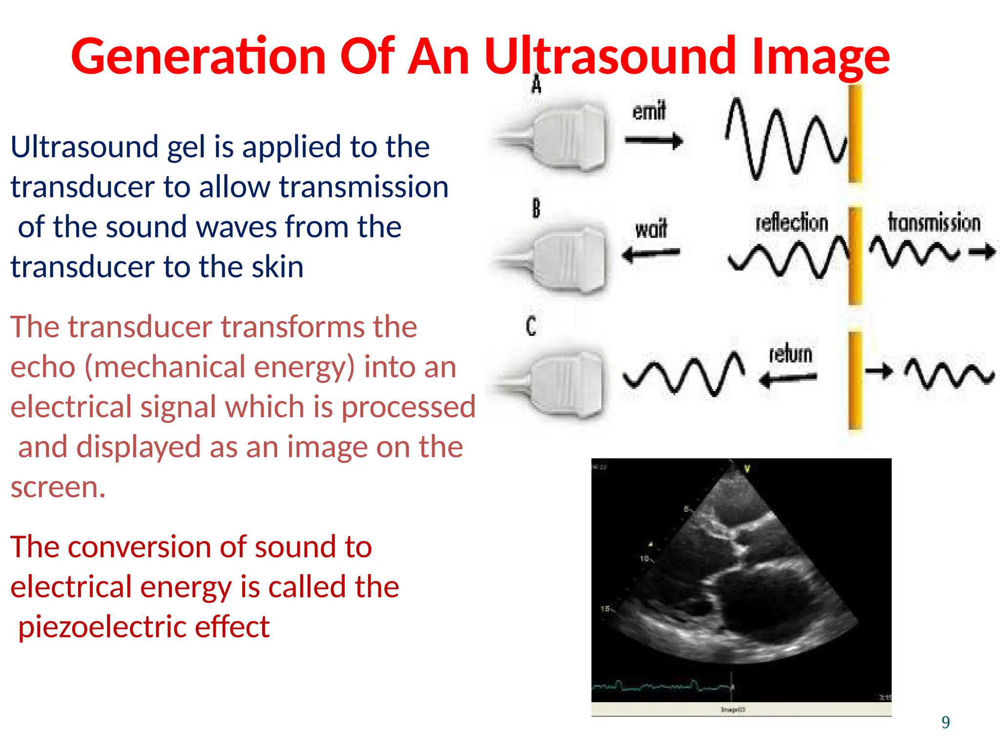 Ultrasound gel is applied to the
transducer to allow transmission
of the sound waves from the
transducer to the skin
The transducer transforms the
echo (mechanical energy) into an
electrical signal which is processed
and displayed as an image on the
screen.
The conversion of sound to
electrical energy is called the
piezoelectric effect
9
Generation Of An Ultrasound Image
 