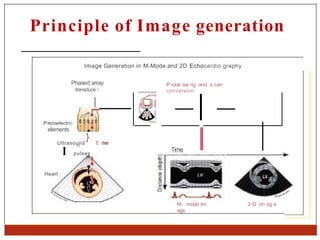 Basics of transoesphageal echocardiography | PPTX