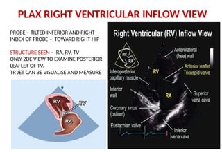 Basics of transoesphageal echocardiography | PPTX