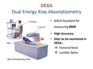 DEXA
Dual Energy Xray Absorptiometry
• GOLD Standard for
measuring BMD
• High Accuracy
• Sites to be examined in
DEXA :
 Femoral Neck
 Lumbar Spine
 
