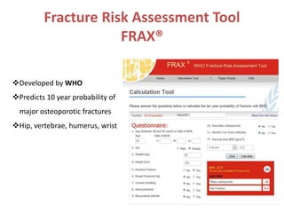 Fracture Risk Assessment Tool
FRAX®
Developed by WHO
Predicts 10 year probability of
major osteoporotic fractures
Hip, vertebrae, humerus, wrist
 