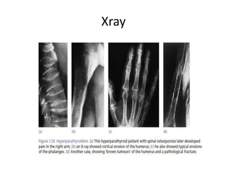 Xray
 