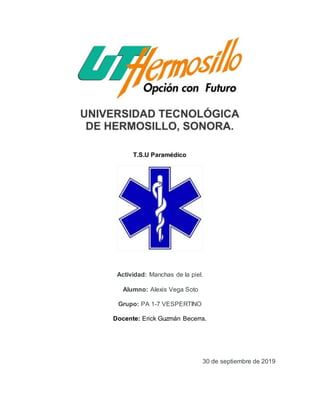 T.S.U Paramédico
Actividad: Manchas de la piel.
Alumno: Alexis Vega Soto
Grupo: PA 1-7 VESPERTINO
Docente: Erick Guzmán Becerra.
30 de septiembre de 2019
 