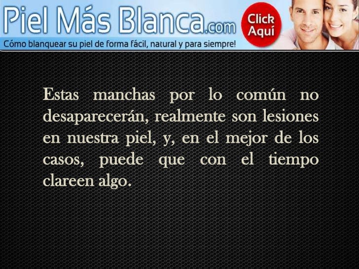 El mejor maquillaje de color para la piel con las pecas