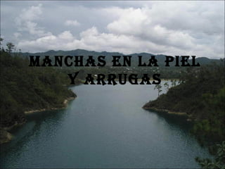 MANCHAS EN LA PIEL Y ARRUGAS 