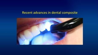 Recent advances in dental composite
1
 