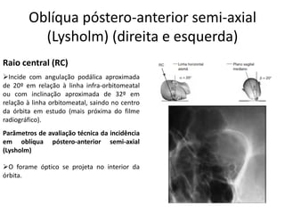 Oblíqua póstero-anterior semi-axial
(Lysholm) (direita e esquerda)
Raio central (RC)
➢Incide com angulação podálica aproximada
de 20º em relação à linha infra-orbitomeatal
ou com inclinação aproximada de 32º em
relação à linha orbitomeatal, saindo no centro
da órbita em estudo (mais próxima do filme
radiográfico).
Parâmetros de avaliação técnica da incidência
em oblíqua póstero-anterior semi-axial
(Lysholm)
➢O forame óptico se projeta no interior da
órbita.
 