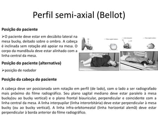 Perfil semi-axial (Bellot)
Posição do paciente
➢O paciente deve estar em decúbito lateral na
mesa bucky, deitado sobre o ombro. A cabeça
é inclinada sem rotação até apoiar na mesa. O
corpo da mandíbula deve estar alinhado com a
linha central da mesa.
Posição do paciente (alternativa)
➢posição de nadador
Posição da cabeça do paciente
A cabeça deve ser posicionada sem rotação em perfil (de lado), com o lado a ser radiografado
mais próximo do filme radiográfico. Seu plano sagital mediano deve estar paralelo à mesa
bucky(ou ao bucky vertical) e o plano frontal biauricular, perpendicular e coincidente com a
linha central da mesa. A linha interpupilar (linha interorbitária) deve estar perpendicular à mesa
bucky (ou ao bucky vertical). A linha infra-orbitomeatal (linha horizontal alemã) deve estar
perpendicular à borda anterior do filme radiográfico.
 