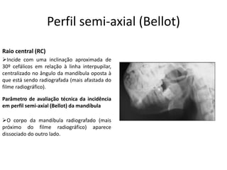 Perfil semi-axial (Bellot)
➢Incide com uma inclinação aproximada de
30º cefálicos em relação à linha interpupilar,
centralizado no ângulo da mandíbula oposta à
que está sendo radiografada (mais afastada do
filme radiográfico).
Raio central (RC)
Parâmetro de avaliação técnica da incidência
em perfil semi-axial (Bellot) da mandíbula
➢O corpo da mandíbula radiografado (mais
próximo do filme radiográfico) aparece
dissociado do outro lado.
 