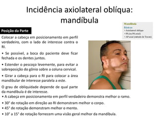 Incidência axiolateral oblíqua:
mandíbula
Posição da Parte
• 10° a 15° de rotação fornecem uma visão geral melhor da mandíbula.
Colocar a cabeça em posicionamento em perfil
verdadeiro, com o lado de interesse contra o
RI.
• Se possível, a boca do paciente deve ficar
fechada e os dentes juntos.
• Estender o pescoço levemente, para evitar a
sobreposição do gônio sobre a coluna cervical.
• Girar a cabeça para o RI para colocar a área
mandibular de interesse paralela a este.
O grau de obliquidade depende de qual parte
da mandíbula é de interesse.
• A cabeça em posicionamento em perfil verdadeiro demonstra melhor o ramo.
• 30° de rotação em direção ao RI demonstram melhor o corpo.
• 45° de rotação demonstram melhor o mento.
 