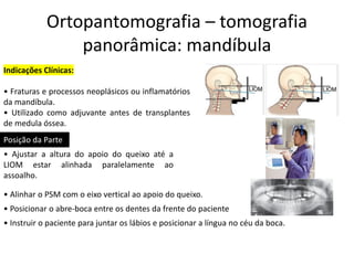 Ortopantomografia – tomografia
panorâmica: mandíbula
Indicações Clínicas:
• Fraturas e processos neoplásicos ou inflamatórios
da mandíbula.
• Utilizado como adjuvante antes de transplantes
de medula óssea.
• Instruir o paciente para juntar os lábios e posicionar a língua no céu da boca.
Posição da Parte
• Ajustar a altura do apoio do queixo até a
LIOM estar alinhada paralelamente ao
assoalho.
• Alinhar o PSM com o eixo vertical ao apoio do queixo.
• Posicionar o abre-boca entre os dentes da frente do paciente
 