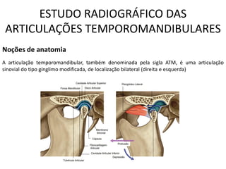 ESTUDO RADIOGRÁFICO DAS
ARTICULAÇÕES TEMPOROMANDIBULARES
Noções de anatomia
A articulação temporomandibular, também denominada pela sigla ATM, é uma articulação
sinovial do tipo gínglimo modificada, de localização bilateral (direita e esquerda)
 