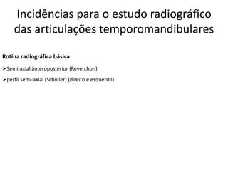 Incidências para o estudo radiográfico
das articulações temporomandibulares
Rotina radiográfica básica
➢Semi-axial ânteroposterior (Reverchon)
➢perfil semi-axial (Schüller) (direito e esquerdo)
 