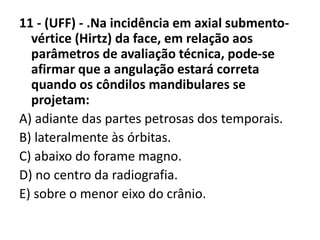 11 - (UFF) - .Na incidência em axial submento-
vértice (Hirtz) da face, em relação aos
parâmetros de avaliação técnica, pode-se
afirmar que a angulação estará correta
quando os côndilos mandibulares se
projetam:
A) adiante das partes petrosas dos temporais.
B) lateralmente às órbitas.
C) abaixo do forame magno.
D) no centro da radiografia.
E) sobre o menor eixo do crânio.
 