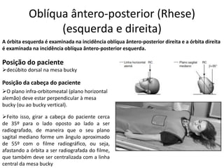 Oblíqua ântero-posterior (Rhese)
(esquerda e direita)
A órbita esquerda é examinada na incidência oblíqua ântero-posterior direita e a órbita direita
é examinada na incidência oblíqua ântero-posterior esquerda.
Posição do paciente
➢decúbito dorsal na mesa bucky
Posição da cabeça do paciente
➢O plano infra-orbitomeatal (plano horizontal
alemão) deve estar perpendicular à mesa
bucky (ou ao bucky vertical).
➢Feito isso, girar a cabeça do paciente cerca
de 35º para o lado oposto ao lado a ser
radiografado, de maneira que o seu plano
sagital mediano forme um ângulo aproximado
de 55º com o filme radiográfico, ou seja,
afastando a órbita a ser radiografada do filme,
que também deve ser centralizada com a linha
central da mesa bucky
 