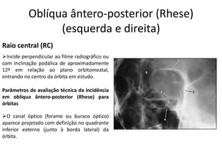Oblíqua ântero-posterior (Rhese)
(esquerda e direita)
Raio central (RC)
➢Incide perpendicular ao filme radiográfico ou
com inclinação podálica de aproximadamente
12º em relação ao plano orbitomeatal,
entrando no centro da órbita em estudo.
Parâmetros de avaliação técnica da incidência
em oblíqua ântero-posterior (Rhese) para
órbitas
➢O canal óptico (forame ou buraco óptico)
aparece projetado com definição no quadrante
inferior externo (junto à borda lateral) da
órbita.
 