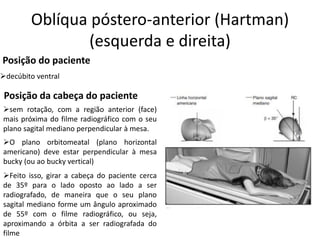 Oblíqua póstero-anterior (Hartman)
(esquerda e direita)
Posição do paciente
➢decúbito ventral
Posição da cabeça do paciente
➢sem rotação, com a região anterior (face)
mais próxima do filme radiográfico com o seu
plano sagital mediano perpendicular à mesa.
➢O plano orbitomeatal (plano horizontal
americano) deve estar perpendicular à mesa
bucky (ou ao bucky vertical)
➢Feito isso, girar a cabeça do paciente cerca
de 35º para o lado oposto ao lado a ser
radiografado, de maneira que o seu plano
sagital mediano forme um ângulo aproximado
de 55º com o filme radiográfico, ou seja,
aproximando a órbita a ser radiografada do
filme
 