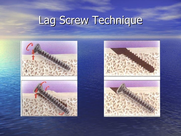 Mandible fxslides040526