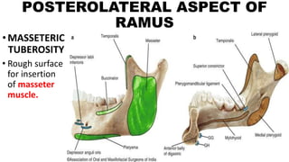 POSTEROLATERAL ASPECT OF
RAMUS
•MASSETERIC
TUBEROSITY
• Rough surface
for insertion
of masseter
muscle.
 