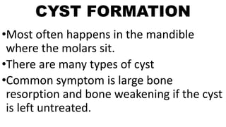 CYST FORMATION
•Most often happens in the mandible
where the molars sit.
•There are many types of cyst
•Common symptom is large bone
resorption and bone weakening if the cyst
is left untreated.
 